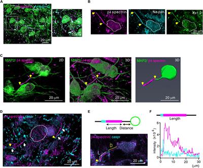 Impact of Auditory Experience on the Structural Plasticity of the AIS in the Mouse Brainstem Throughout the Lifespan